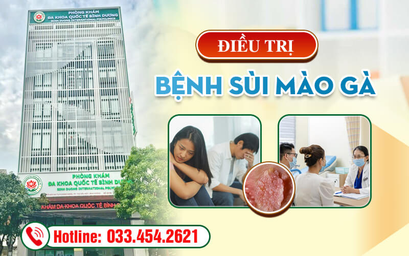 Điều trị bệnh sùi mào gà