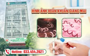 Hình ảnh xoắn khuẩn giang mai