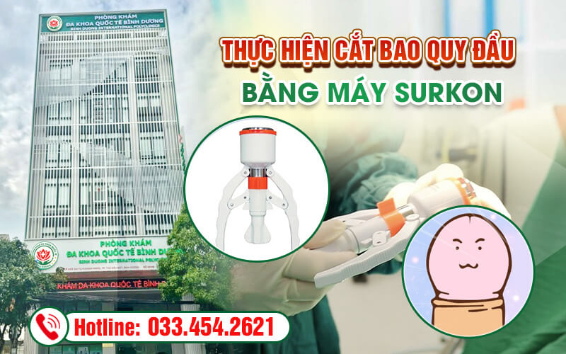 Thực hiện cắt bao quy đầu bằng máy surkon