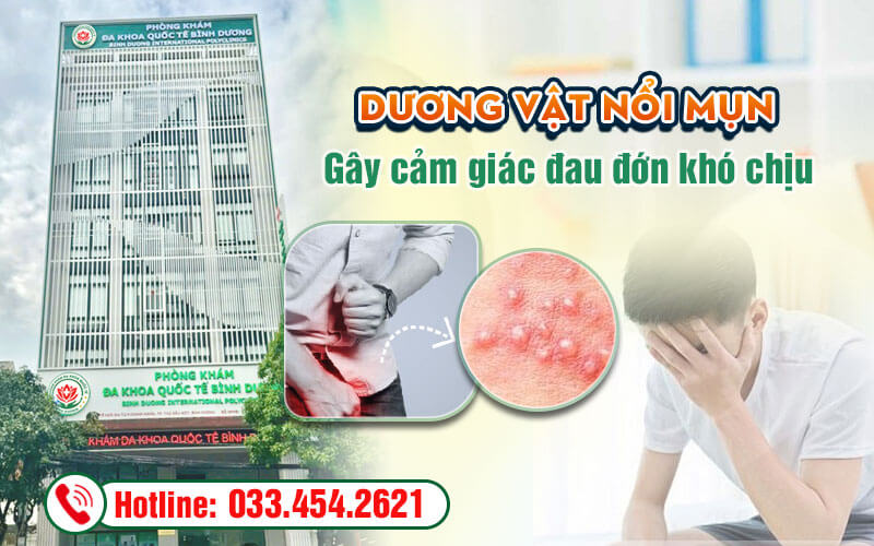 Dương vật nổi mụn gây cảm giác đau đớn khó chịu
