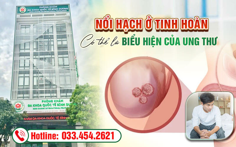 Nổi hạch ở tinh hoàn có thể là biểu hiện của ung thư