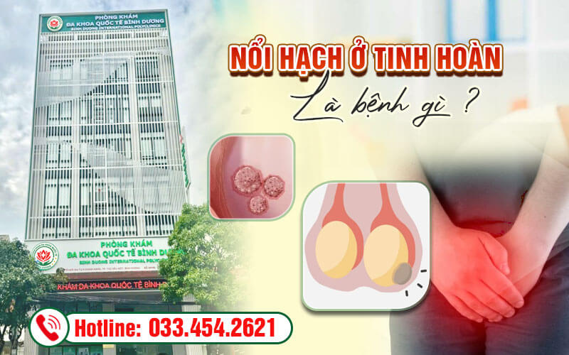 Nổi hạch ở tinh hoàn là bệnh gì?