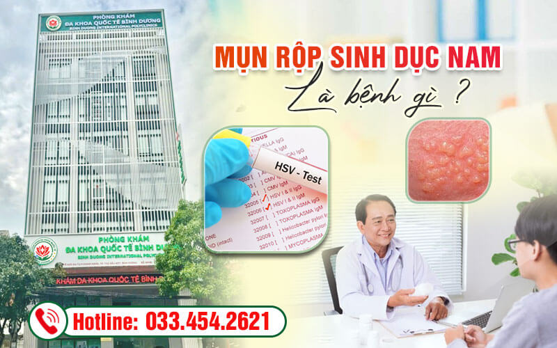 Xét nghiệm và điều trị sớm mụn rộp sinh dục nam