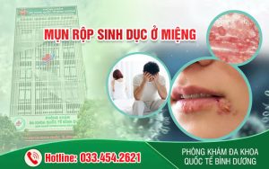 Mụn rộp sinh dục ở miệng lưỡi là gì? có nguy hiểm không?