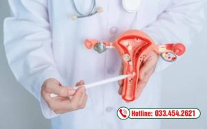 Polyp cổ tử cung là gì?