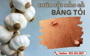 Cách chữa sùi mào gà bằng tỏi có tốt không?