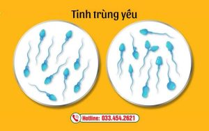 Nhận biết các dấu hiệu tinh trùng yếu