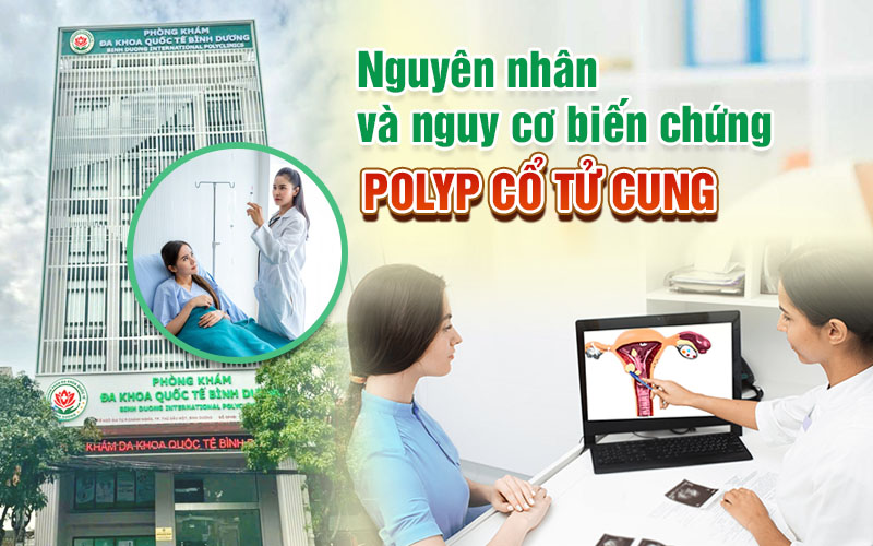 Tìm hiểu nguyên nhân và nguy cơ biến chứng của polyp cổ tử cung