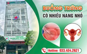 Tổng quan buồng trứng có nhiều nang nhỏ