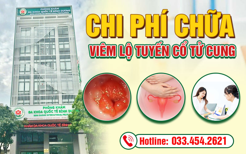 Chi phí chữa viêm lộ tuyến cổ tử cung