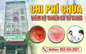 Chi phí chữa viêm lộ tuyến cổ tử cung