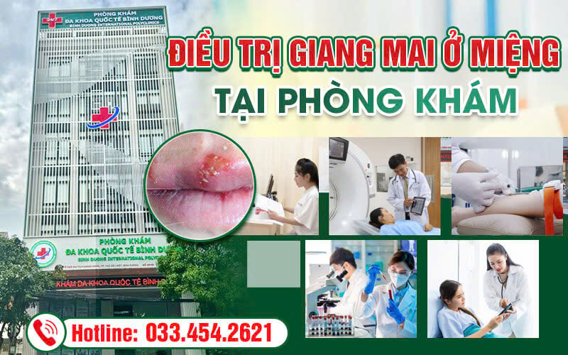Điều trị hiệu quả bệnh giang mai ở miệng