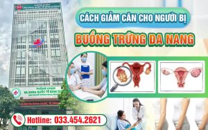 Cách giảm cân cho người bị đa nang buồng trứng hiệu quả