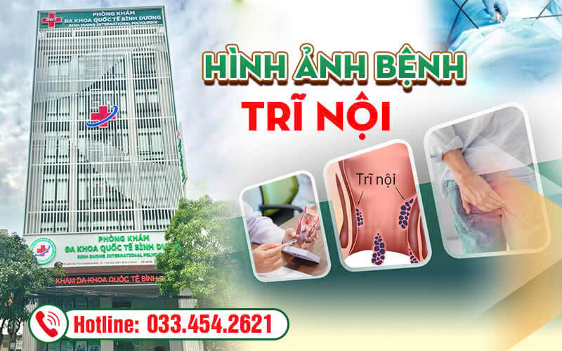 Hình ảnh bệnh trĩ nội