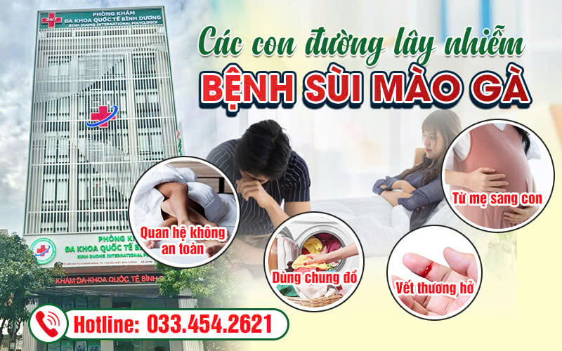 Giải đáp sùi mào gà lây qua đường nào?