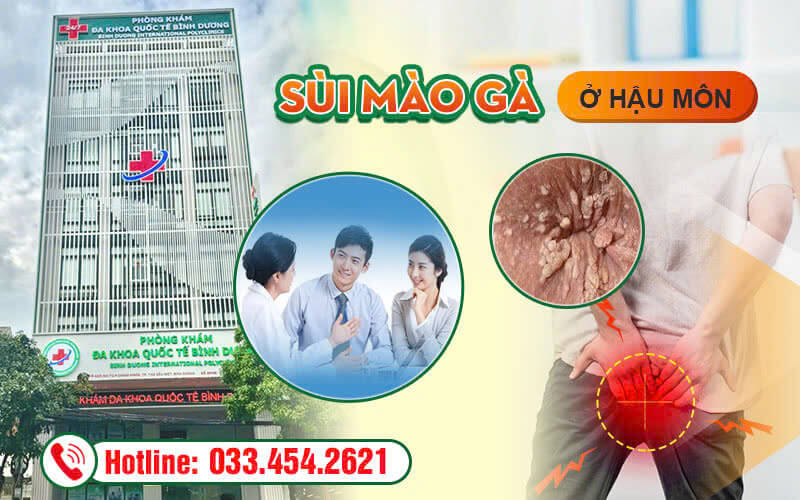 Tìm hiểu sùi mào gà hậu môn